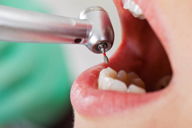 Best Emergency Root Canal Treatment in Masontown, PA
